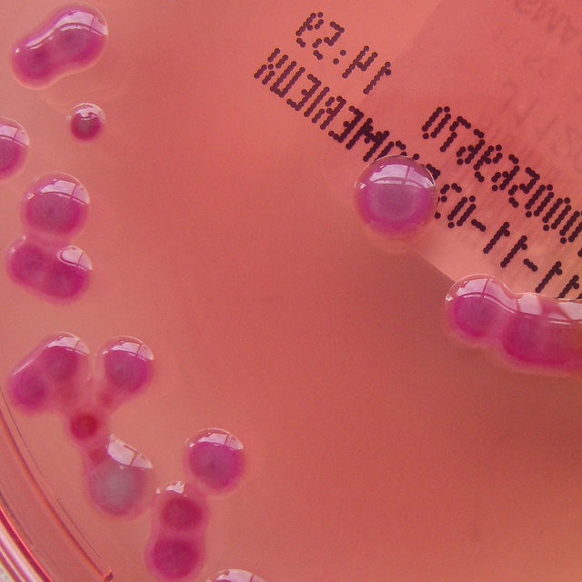 CT-SMAC Agar 2- detail via nathanreading on Flickr CC BY-NC-ND 2.0